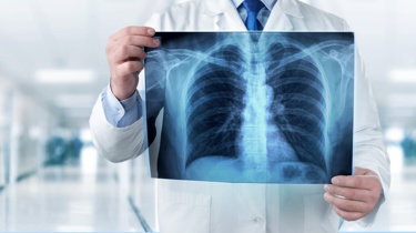 Ψηφιακή Ακτινολογία